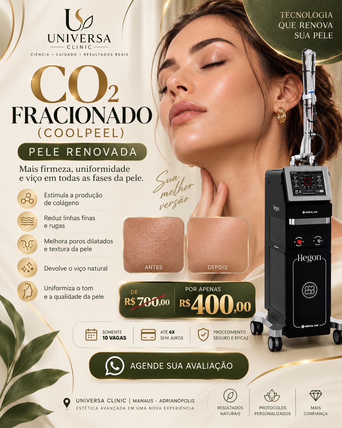 Promoção especial de CO₂ Fracionado CoolPeel, de R$ 700 por R$ 400, com 10 vagas por tempo limitado.
