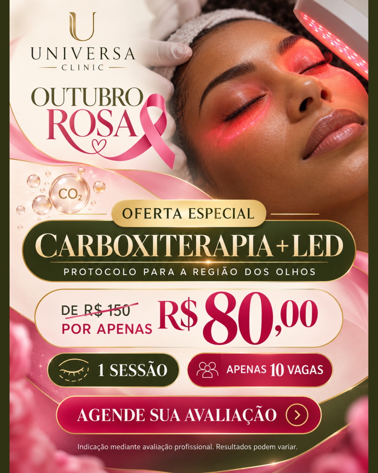 Oferta Outubro Rosa de Carboxiterapia com LED para a região dos olhos, por R$ 80, com uma sessão e 10 vagas.
