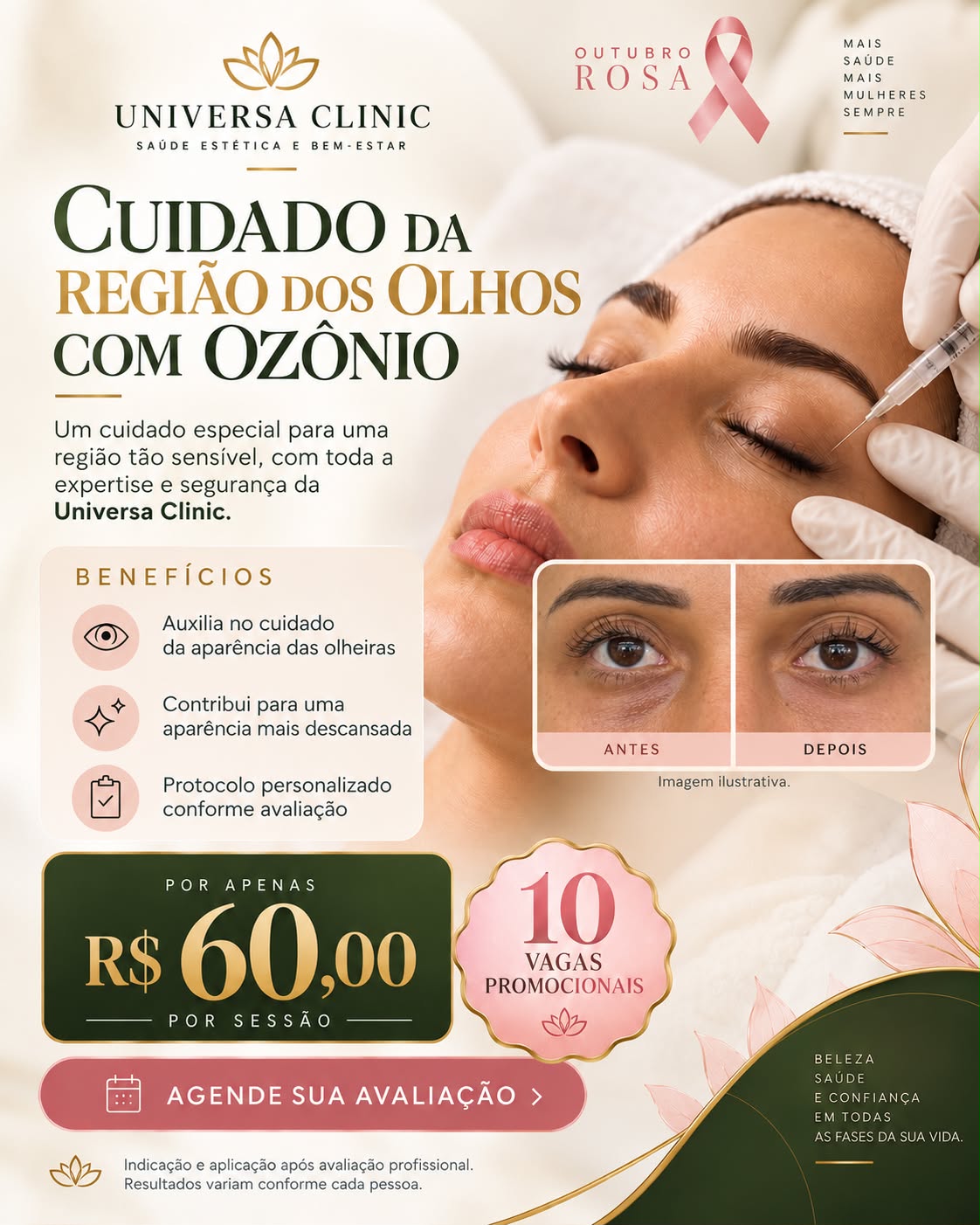 Cuidado da região dos olhos com ozônio por R$ 60 a sessão, com 10 vagas promocionais.