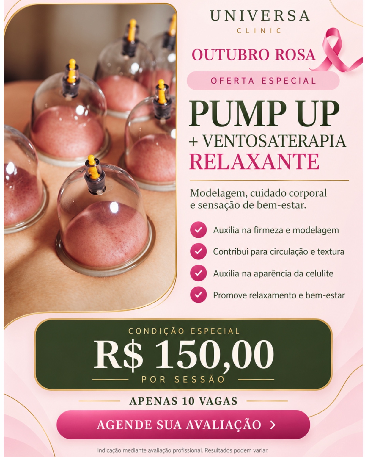 Pump Up com ventosaterapia relaxante por R$ 150 a sessão.